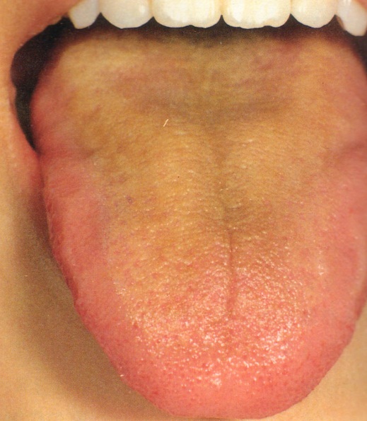 自分で出来る！「舌」で健康チェック  大阪医療技術学園専門学校 